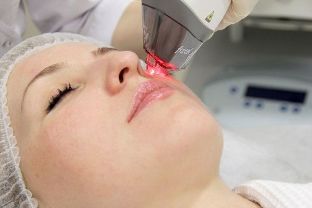 The process of skin rejuvenation with fractional lasers