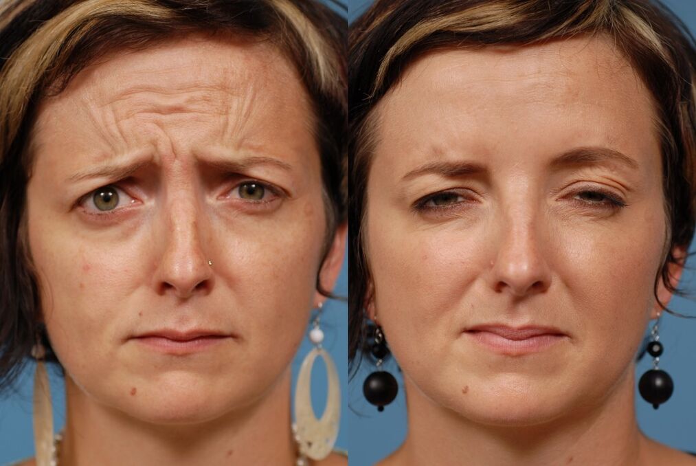 before and after using massage tools for rejuvenation ltza photo 2