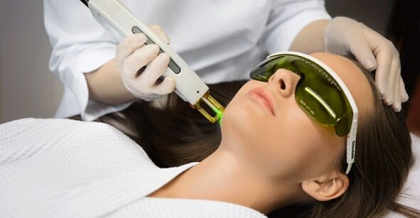 Non-ablative laser skin rejuvenation procedures